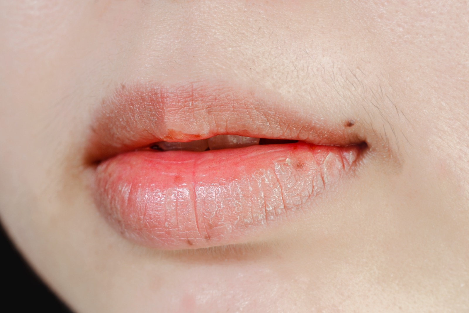 Ozgin onani sikdi Birinchi marta eshak porno